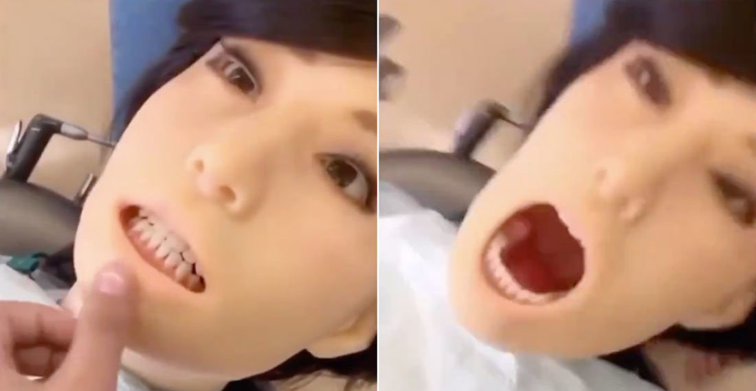 Yikes!: Video Of Malfunctioning Dental Practice Robot