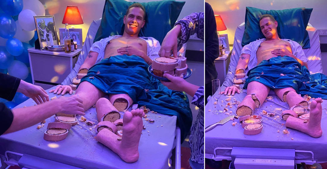 Freaky Deaky: Half Man, Half Realistic Cake-Man In Hospital Bed