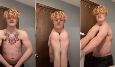 Holy Smokes: Guy Born Without Collarbones Can Clap His Shoulders
