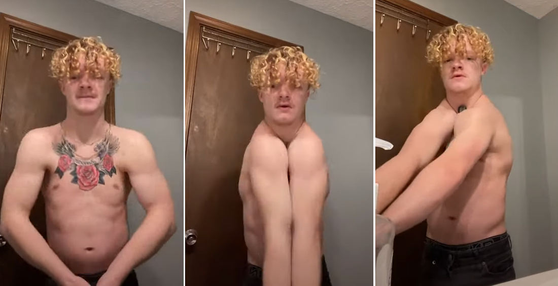 Holy Smokes: Guy Born Without Collarbones Can Clap His Shoulders