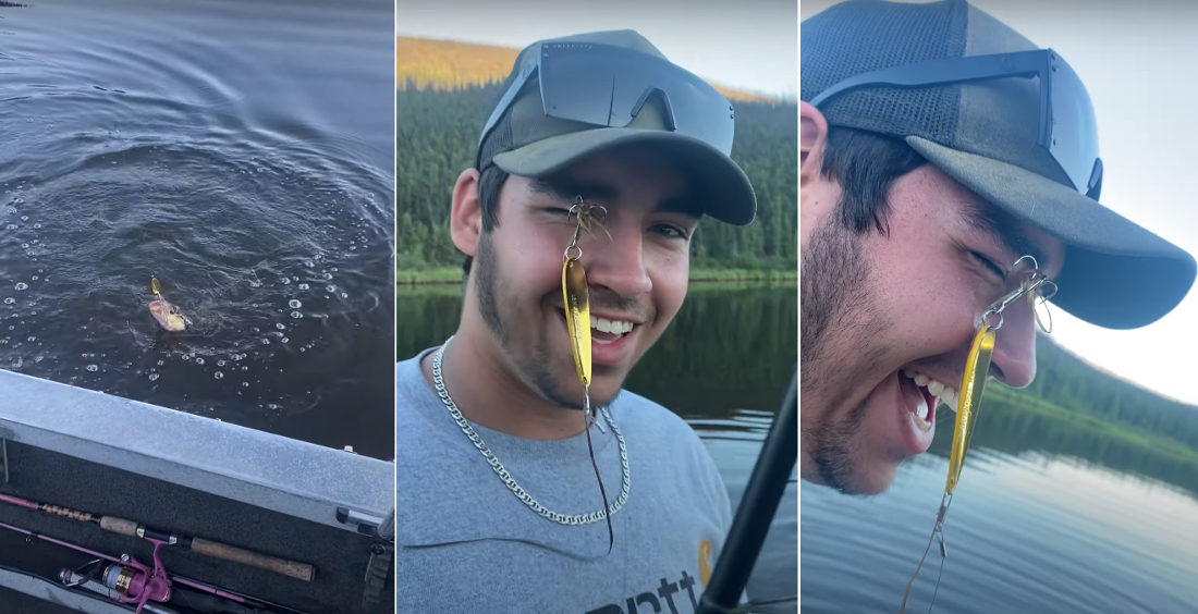 Close Calls: Hook Comes Loose From Fish, Catches Fisherman In Eyebrow