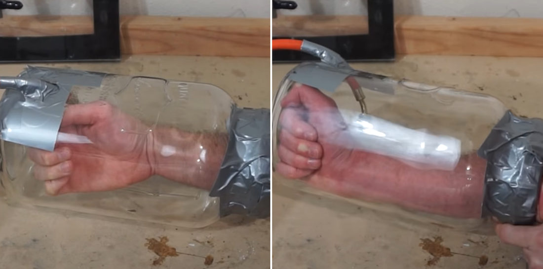 Doing Science: Man Puts Arm In Vacuum Chamber