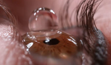 Slow Motion Closeup Of Eye Drop In Eyeball