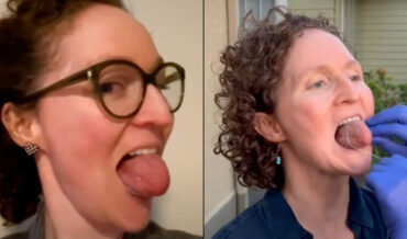 Guinness World Record For Largest Circumference Female Tongue
