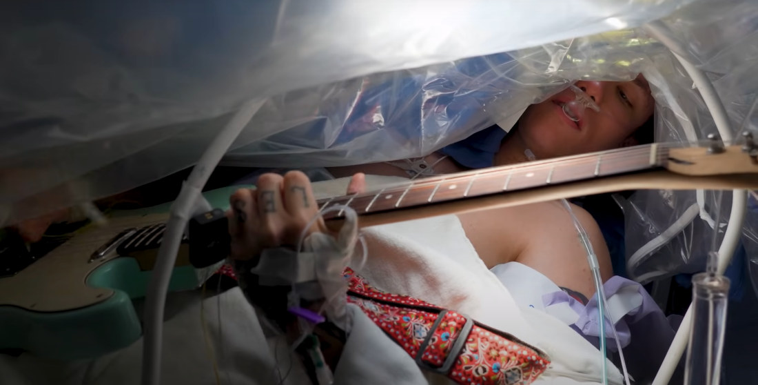 Man Plays Guitar While Undergoing Brain Surgery