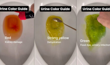 What Your Urine Color Says About Your Health