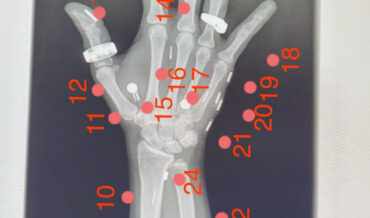 ‘Biohacking Magician’ Has World Record For Most Technological Implants In Body (Over 50!)